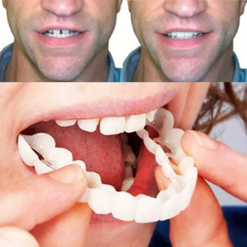 Comfortable Flex Dentures for Top & Bottom Teeth | White Cosmetic Cover