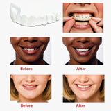 Comfortable Flex Dentures for Top & Bottom Teeth | White Cosmetic Cover